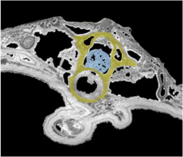 Figure 2 Tomogram of the trunk portion of the specimen MNHN.F.QU17755. Spinal cord is in blue, within the neural canal of a trunk vertebra (in yellow).