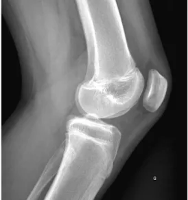 Illustration  1  :  Radiographie  d'un  genou  sain  (mise  à  disposition  par  Hugues  Brat,  Institut  de  Radiologie de Sion, 2017)