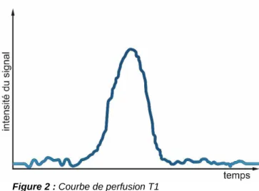 Figure 2 : Courbe de perfusion T1