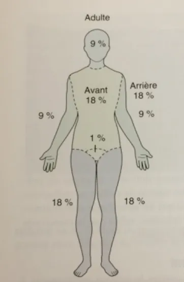 Figure 1. Règle des 9 de Wallace  Tirée de : NAEMT, 2012 