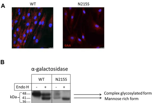 Figure 1. GAA mutations in the GAA-coding region affects its maturation and intracellular localization