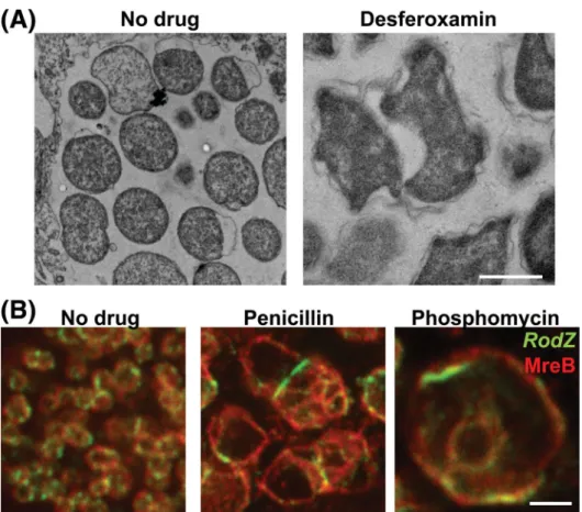 Figure Box 2. Aberrant bodies caused by different stimuli. (A) Electron microscopy pictures of W
