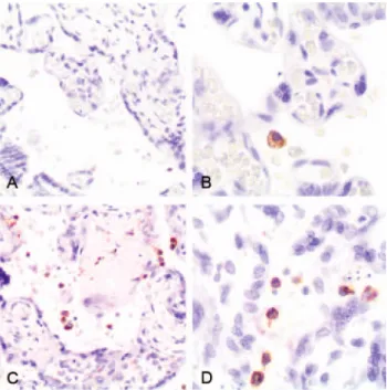 Figure 4. Number of CD45 + (leukocytes) and CD68 + (macrophages) cells after examination of 10 high-power ﬁ elds (HPF; ×400) in placentas with Plasmodium vivax and Plasmodium falciparum monoinfection and uninfected placentas
