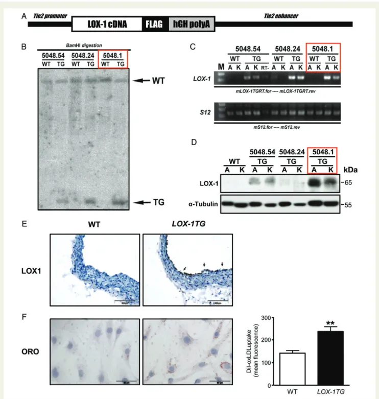 Figure 1 Generation and characterization of endothelial-specific LOX-1TG mice. (A) Scheme of endothelial-specific LOX-1 transgenic construct.