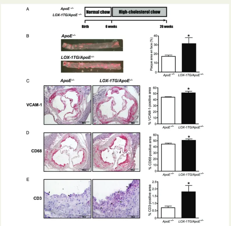 Figure 3 Increased aortic plaque formation and inflammation in LOX-1TG/ApoE 2/2 mice. (A) Twenty-six-week-old mice were sacrificed for tissue isolation