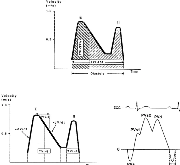 Fig. 1. Schematic representation of transmitral and pulmonary venous flow pattern. The upper panel shows early diastolic (E ) and atrial filling velocity (A).