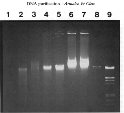 FIG. 1. Agarose-gel electrophoresis of DNA from representative lichens. Thalli were stored at