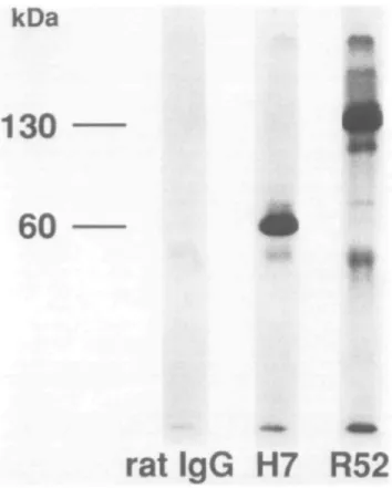 Fig. 3. SDS - PAGE and autoradiography of immunoprecipitation using H7 or R52 mAbs. Y16 cells (2 x 10 7 ) were radioiodinated and membrane-fractions were prepared