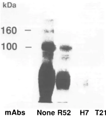 Fig. 7. Fluorograph of chemical cross-linking of [ 35 S]IL-5 binding protein. Y16 cells (2 x 10 7 ) were incubated with [35SJIL-5 (0 3 nM, 2 x 10 s  c.p m ) for 10 min at 37°C in the presence or in the absence of mAbs (10 fig/ml)