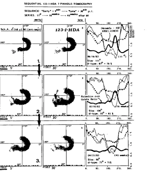 Figure 2 A sequence of three tomoscans (shown are the middle planes only) from the 1 Ith day over 16 weeks to 45 weeks »•