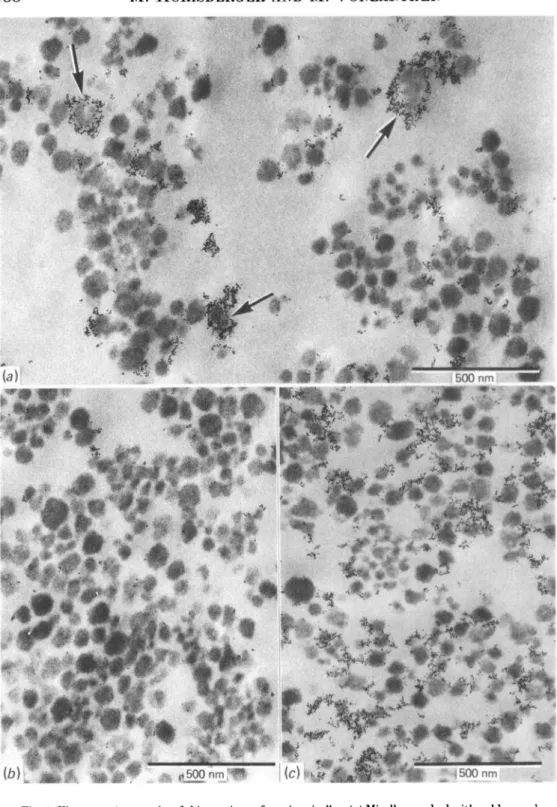 Fig. 1. Electron micrographs of thin sections of casein micelles, (a) Micelles marked with gold granules labelled with the Ricinus communis lectin RCA,