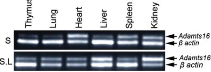 Figure 7. Tissue distribution of Adamts16. Various tissues from one S and one S.LEW (D1Mco4x1x3Bx1) congenic rat (labeled as S.L) were collected after euthanization of the rats by CO 2 inhalation