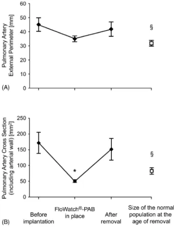 Fig. 6. Clinical data: variations of the pulmonary artery perimeters (A) and the corresponding cross-sectional areas (B), before implantation of FloWatch 1  -PAB, with the device in situ and immediately after explantation, together with the comparison with
