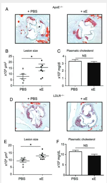 Figure 1 EP increase atherosclerosis development in two athero- athero-sclerotic mouse models