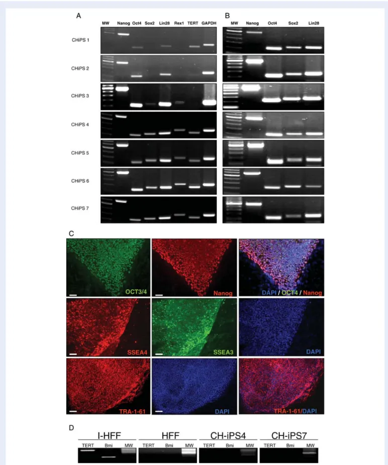 Figure 6 (A) Semi-quantitative RT – PCR expression proﬁle of different endogenous pluripotency markers expressed in iPS cells when derived over the immortalized feeders.