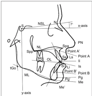 Figure 1         Reference points and lines used in the cephalometric analysis. S,  sella; NSL, nasion-sella-line; N, nasion;   x , horizontal reference plane; NL  nasal line; Ils, upper incisal line; Spp, posterior nasal spine; Spa, spine anterior  nasal;