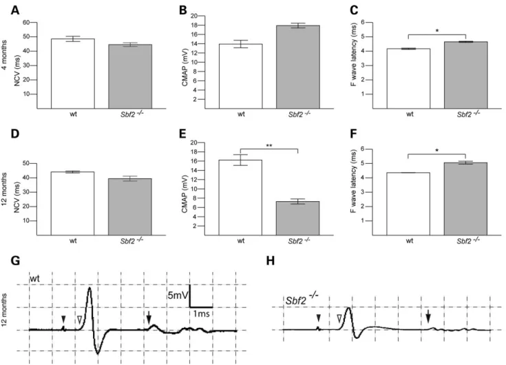 Figure 4. Motor nerve conduction studies of sciatic nerves of 4-month-old (A–C) and 12-month-old animals (D–H)