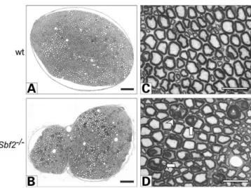 Figure 6. Time course of morphologic changes indicates a progressive neuro- neuro-pathy in Mtmr13/Sbf2-deficient (Sbf22/2) mice
