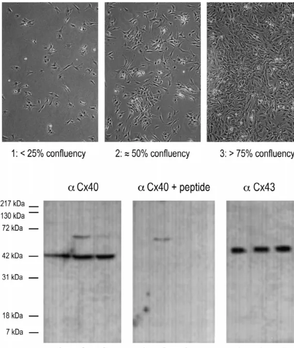 Fig. 5. Expression of Cx40 and Cx43 in neonatal rat ventricular myocytes cultured at various densities for 48 h