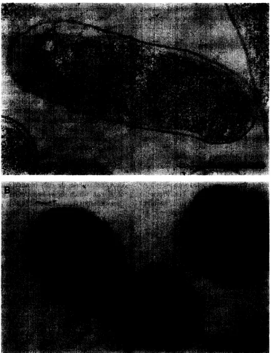 Fig.  1.  Immunolabelling  and  transmission  electron  microscopy  of  oxaloacetate  decarboxylase  expressed  in  K