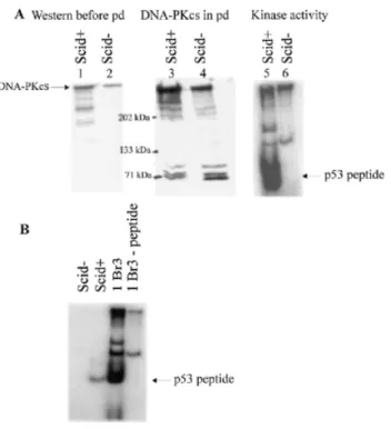 Figure 2. Analysis of DNA-PKcs protein and kinase activity from pre-B bcl2 SCID + and SCID – cells