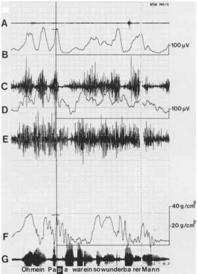 Figure 6 Electromyographic and lip pressure recording of the phrase 'Oh mein Papa war ein so wunderbarer Mann'