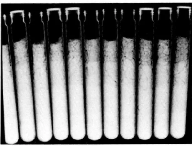 Fig. 5. Test tubes with moisture stratification. One wireworm placed in each tube.