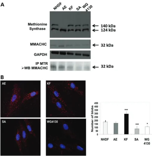 Figure 4. Protein expression of MS and MMACHC in control and cblG-variant, cblG and cblC fibroblasts