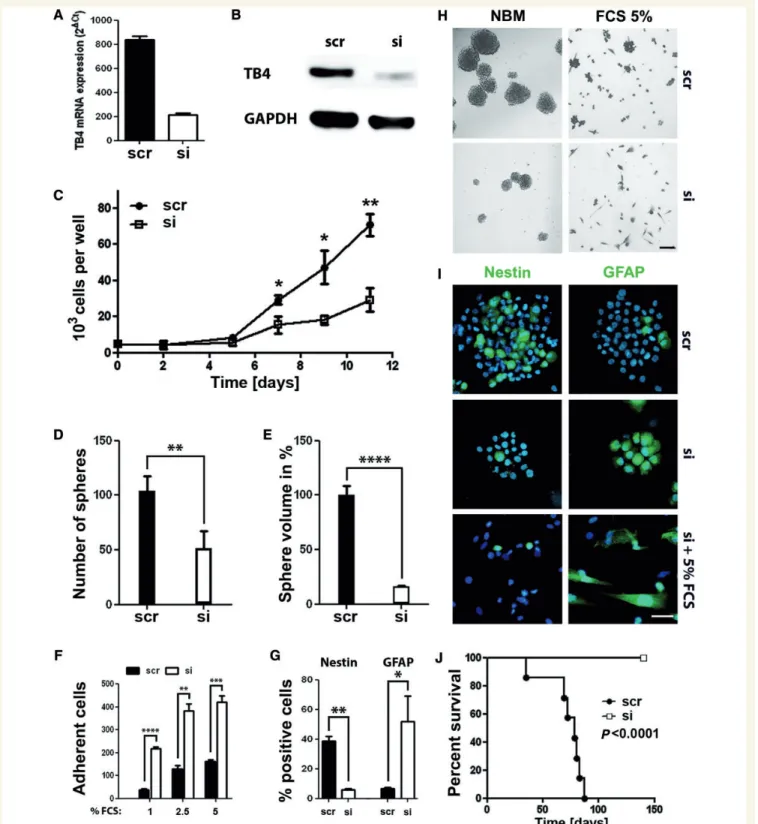 Figure 6 TB4 gene silencing in GS-2 cells inhibits self-renewal, promotes differentiation and improves symptom-free survival in vivo.
