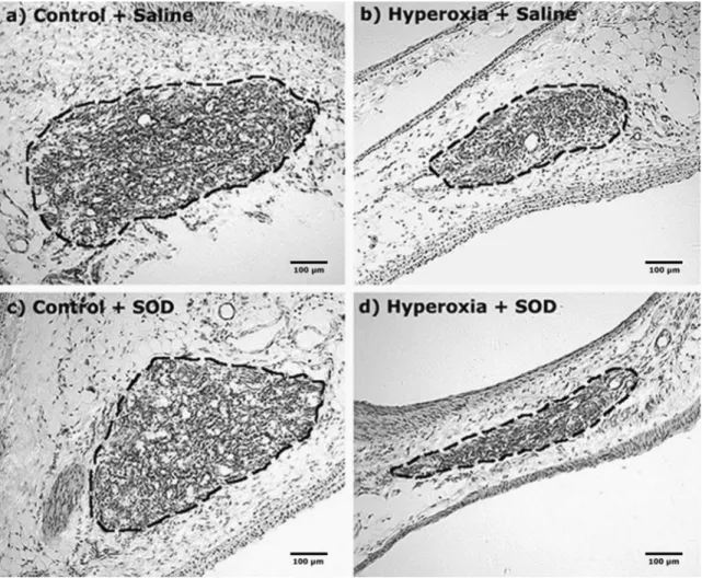 Fig. 6 Representative sections through the carotid body of adult rats exposed to hyperoxia (60% O 2 ) for the first two postnatal weeks, with or without daily treatment with a superoxide dismutase (SOD) mimetic, manganese (III) tetrakis (1-methyl-4-pyridyl