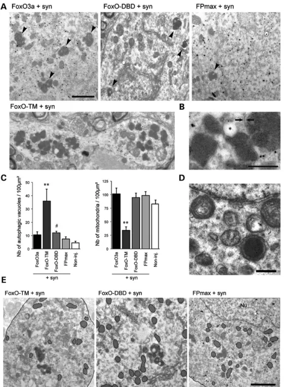 Figure 6.IEM reveals signs of enhanced autophagy in response to the constitutively active FoxO-TM