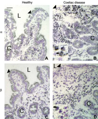 Figure 2 Expression of meprin a in the human foetal gut model of T-cell-mediated mucosal inflammation.