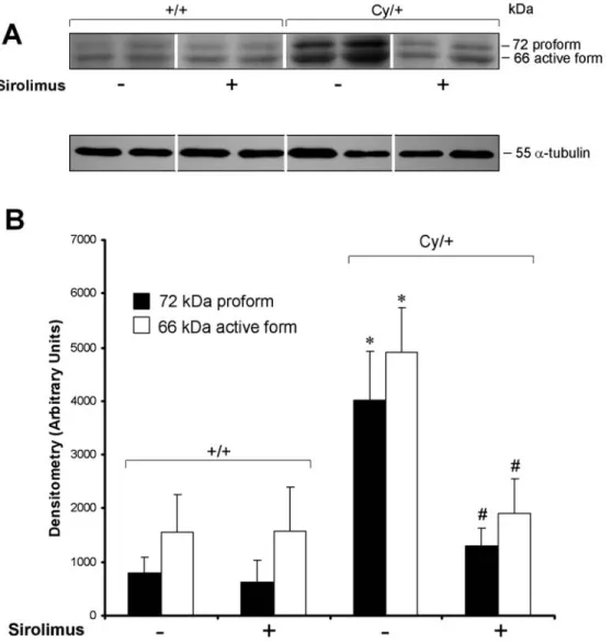 Fig. 2. MMP-2 expression. (A) Western blot and (B) densitometry confirmed the upregulation of the pro- and active forms of MMP-2 in Cy/ + compared to + / + 