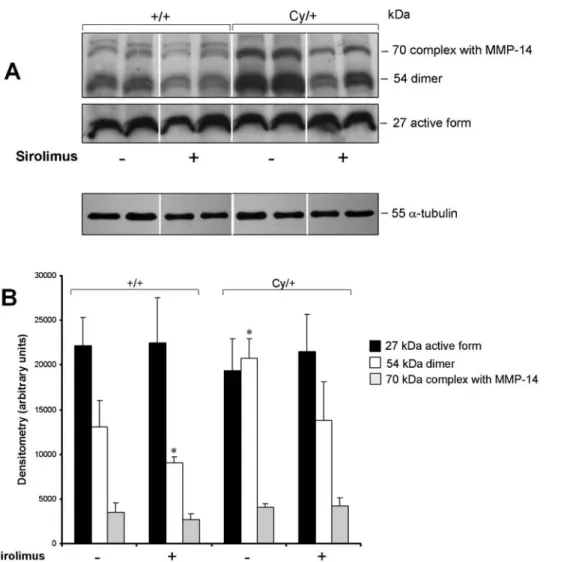Fig. 6. TIMP-2 protein expression. (A) Western blot analyses and (B) densitometry revealed three forms of TIMP-2: the active form (TIMP-2 free form), the dimer TIMP-2 and the complex TIMP-2/MMP-14 are depicted by three bands of 27 kD, 54 kD and 70 kD, resp