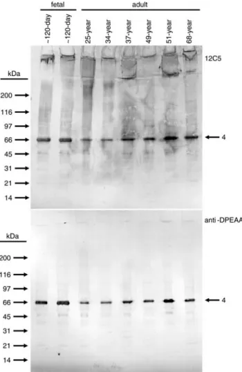 Fig. 3. Versican core protein immunoblot analysis: DEAE pool 1. Material isolated from eight different samples of human skin of the indicated ages and recovered in DEAE pool 1 was subjected to immunoblot analysis for versican core proteins