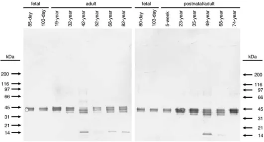 Fig. 5. Decorin core protein analysis. Decorin core protein analysis was done on proteoglycans recovered in DEAE pool 2 for 16 different samples of skin of the indicated ages
