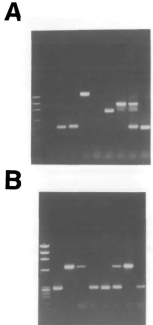 Fig. 2. A representative example of VHJ558-DHJH rearrangments (A) and  V ^ I or 2 rearrangements (B) as found in eight single immature B cells (lanes 2-9) Molecular weight markers are shown in lane 1.