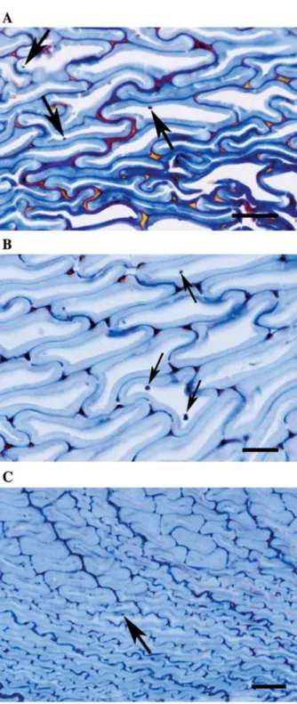 Figure 1 Transverse sections of densified Norway spruce wood; bar represents 10 m m. (A) Post-treated at 1408C and incubated with Poria placenta