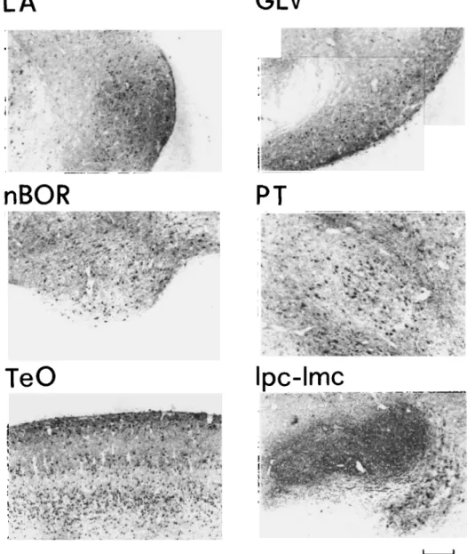 Fig. 11. Patterns of GABA-LI in different visual regions at the adult stage. GLv: n. geniculatus lateralis, pars ventralis; Ipc: