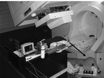 Fig 1 A 2.6-yr-old child under deep propofol sedation for proton therapy in the prone position placed in the whole body mould with the head immobilized by means of a head mask (arrow).