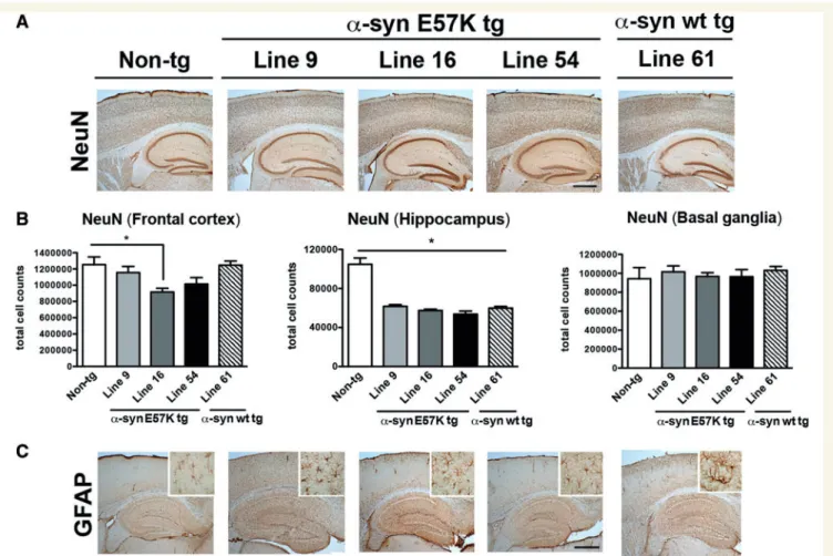 Figure 10 Analysis of neurons and astroglial cells in the -synuclein E57K and -synuclein wild-type transgenic mice