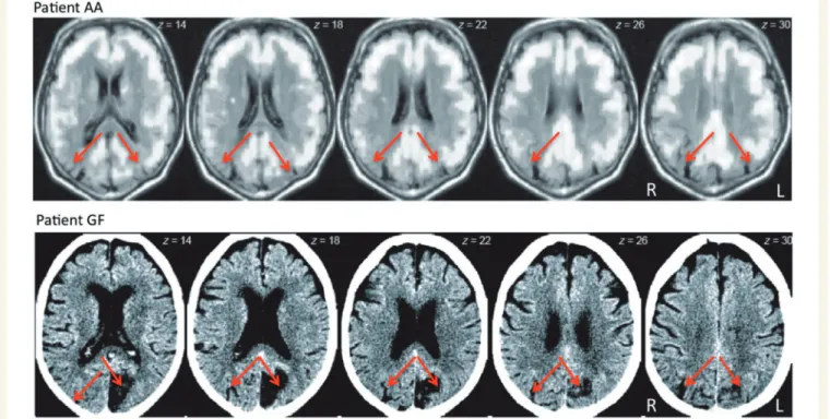 Figure 2 The three kinds of stimuli used to bias processing through the visual pathways