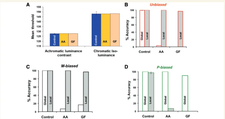 Figure 3 (A) The psychophysical thresholds (in arbitrary units) and accuracy for global–local processing across the three biasing conditions (B–D) in the patients (AA and GF) with simultanagnosia and the elderly control group