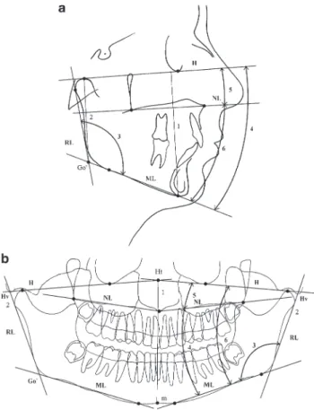 Figure 2      Reference lines used in the analysis of (a) the lateral  cephalometric and (b) the panoramic radiographs