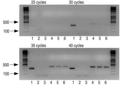Figure 2. (A) Part of the sequence of exon 6 showing the homozygous mutation p.Q434X in the affected children