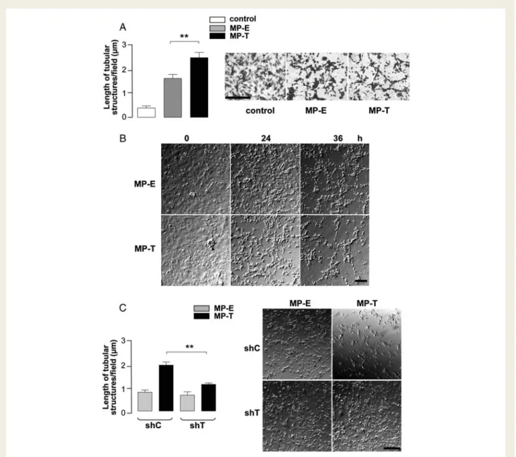 Figure 4 Endothelial MPs expressing T-cad on their surface facilitate angiogenesis in vitro
