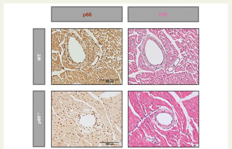Figure 1 P66 Shc expression pattern in mouse hearts. In situ hybridization with p66 Shc mRNA LNA detection probe shows homogeneous expres- expres-sion of p66 Shc in paraffin-embedded cross sections from wild-type (upper row) and p66 Shc2/2 hearts (lower ro