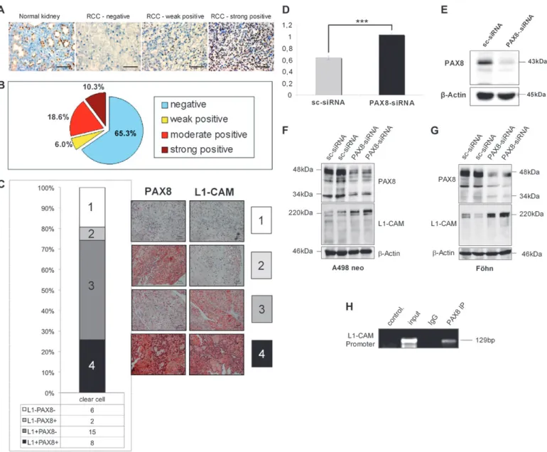 Fig. 6. Expression of PAX8 in normal renal tissue and renal cancer tissue and PAX8 knockdown increases L1-CAM expression
