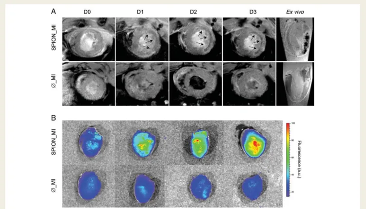 Figure 2 In vivo and ex vivo imaging. In vivo magnetic resonance imaging of the infarcted groups is presented in (A)
