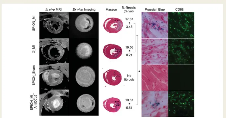 Figure 5 Comparison of all groups at Day 3. SPION_MI clearly showed a hypointense signal by magnetic resonance imaging (in vivo and ex vivo) in the myocardial infarction